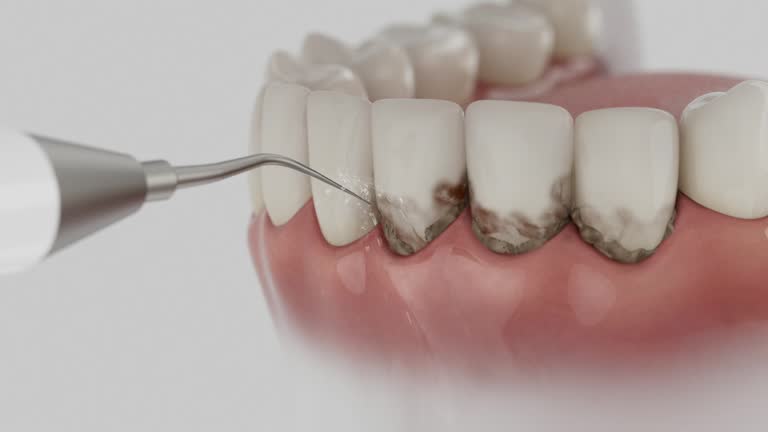 Trusted Emergency Dentist service in Minersville, PA - Dentist Open Now